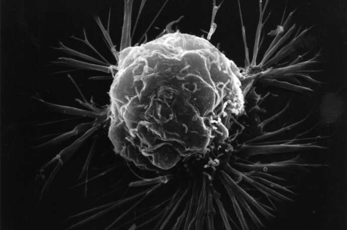 Cellules cancer