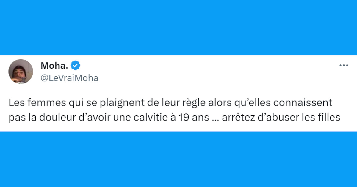 Top 20 des tweets les plus drôles sur la calvitie, pour nos futurs chauves