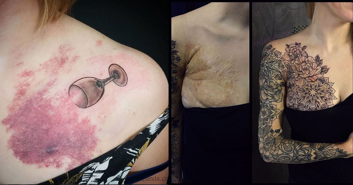 65 Tatouages Originaux Pour Masquer Des Brûlures Cicatrices