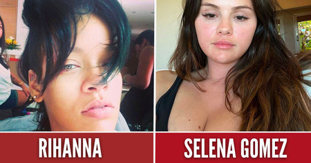 Shakira, Selena Gomez, Katy Perry : 50 célébrités sans filtre