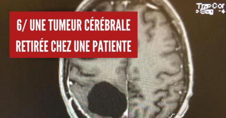 8 cas médicaux aussi incroyables qu'effrayants