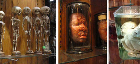 Mütter Museum, le musée des anomalies médicales est vraiment effrayant