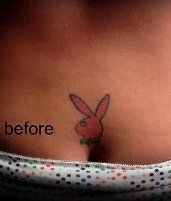 fail remplacement tatouage 4