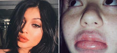 Kylie Jenner Challenge : le nouveau challenge débile des réseaux sociaux 