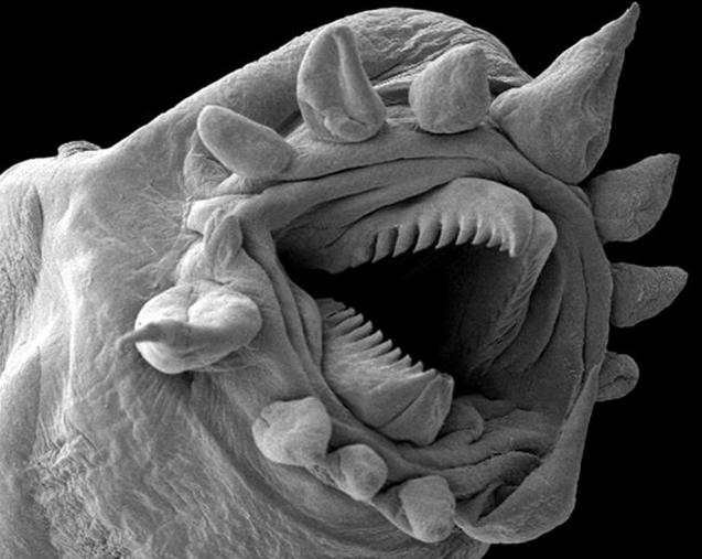 images terrifiantes microscope 15
