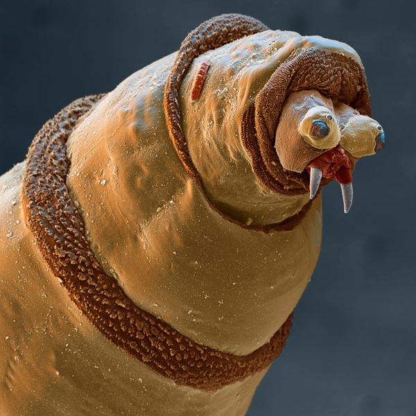 images terrifiantes microscope 10