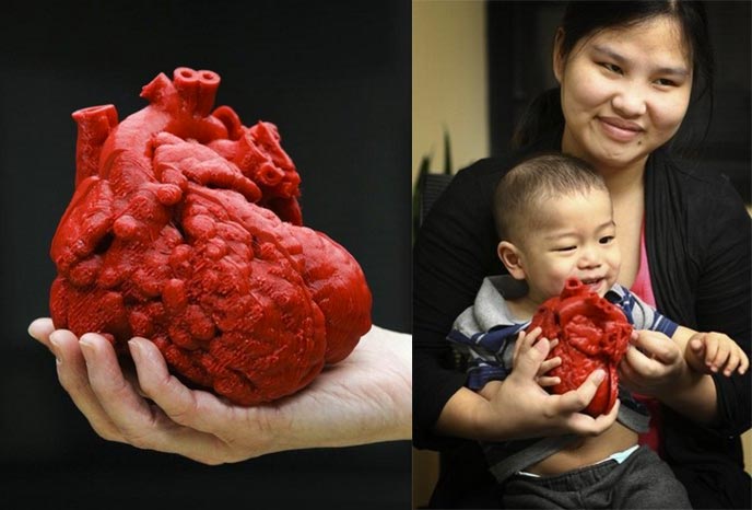 Coeur bébé impression 3D