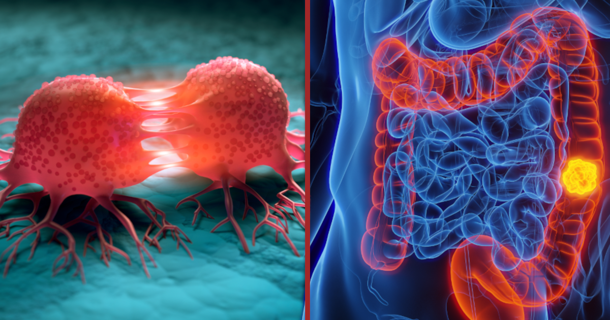 Cancer : cette méthode révolutionnaire pourrait soigner des millions de malades