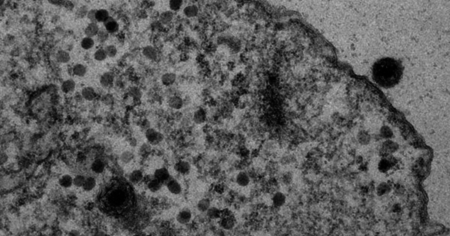 Yaravirus : un énigmatique virus découvert au Brésil