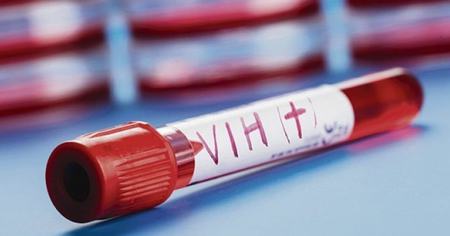 VIH : un patient en rémission durable, un deuxième cas mondial