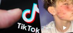 TikTok : 