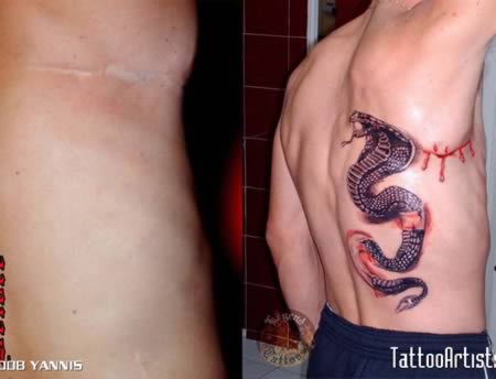 Tatouage cicatrice