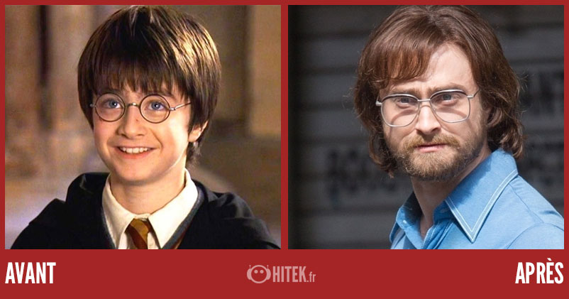Avant Apr S Quoi Ressemblent Ces Acteurs De La Saga Harry Potter En