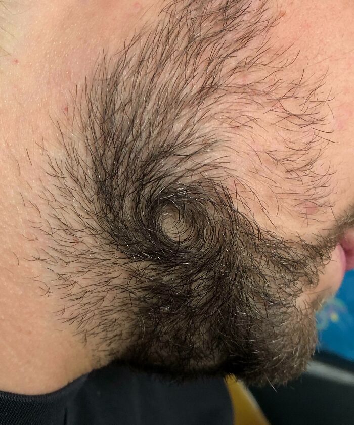poils de barbe en forme d