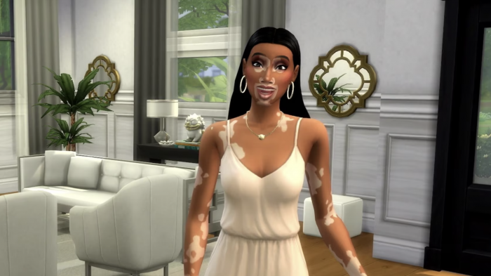 Les Sims 4 vitiligo