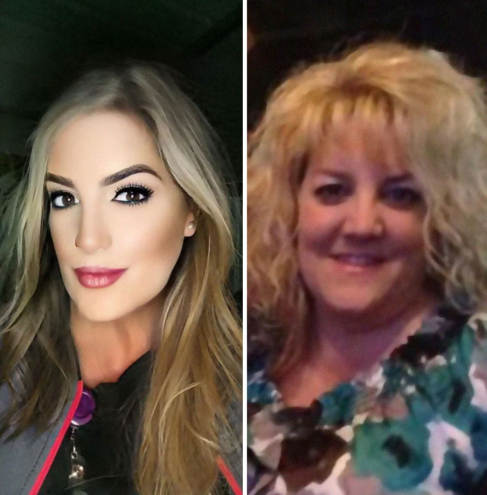femme avant et après