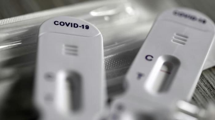 Antigen test for Covid-19