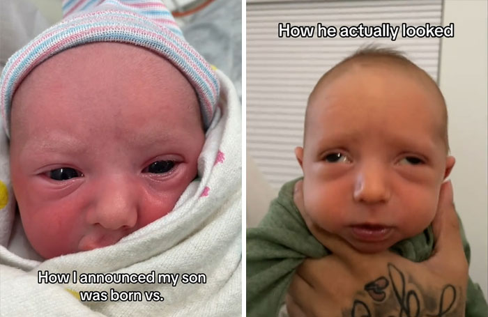 bébé avec des yeux qui divergent