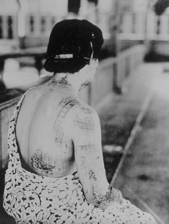 femme_hibakusha