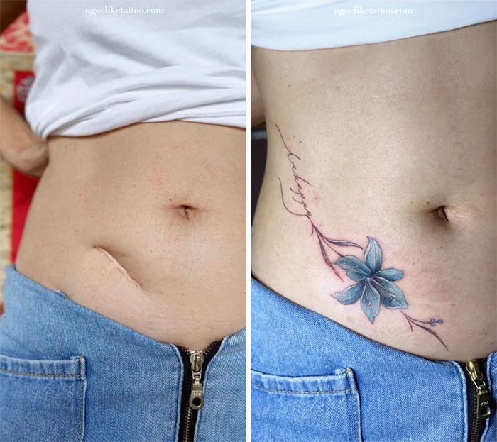 tatouage sur une cicatrice du ventre