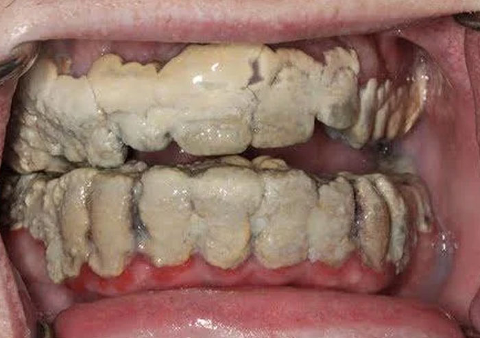 dents sales