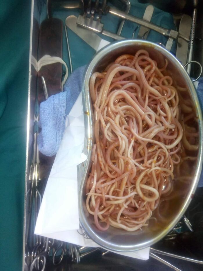 spaghettis