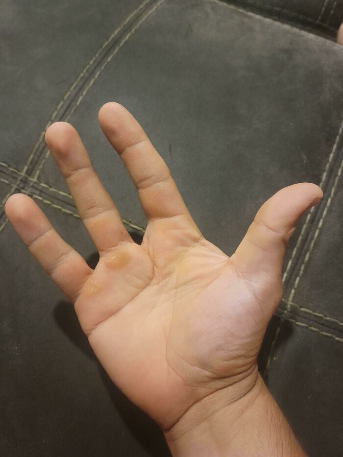 une main à 4 doigts