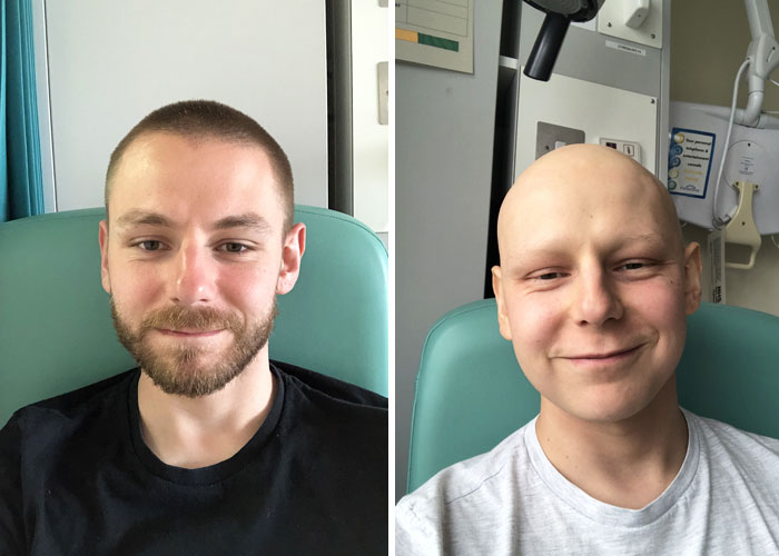 Transformation after chemotherapy