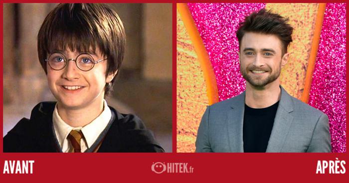 Daniel Radcliffe a bien changé en 20 ans. 